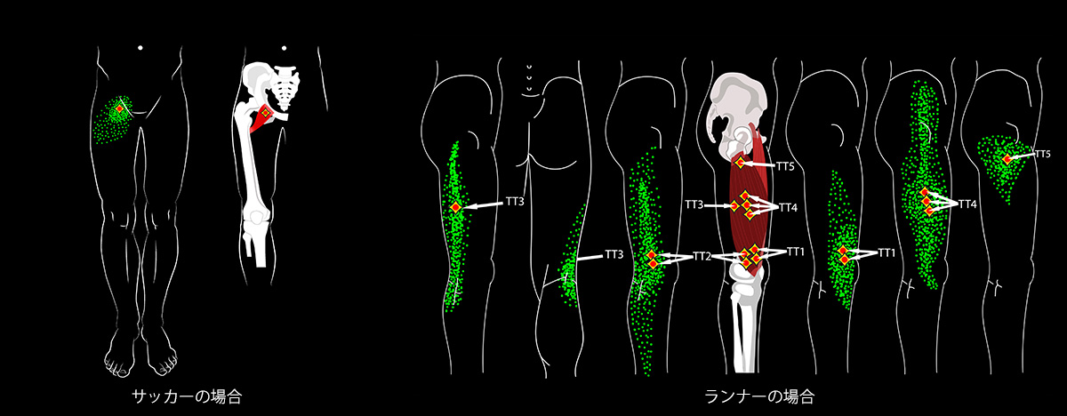 サッカー選手が何度もボールを蹴り、股関節を酷使したり